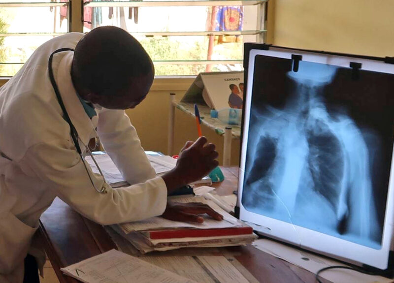 Fotos mida WEB – TB diagnosis